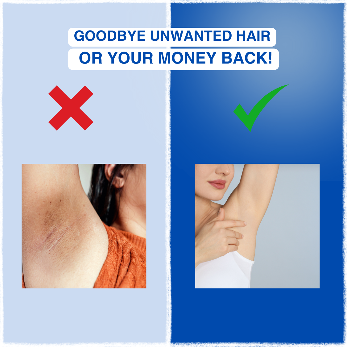 Laserly™ - Laser Hair Removal