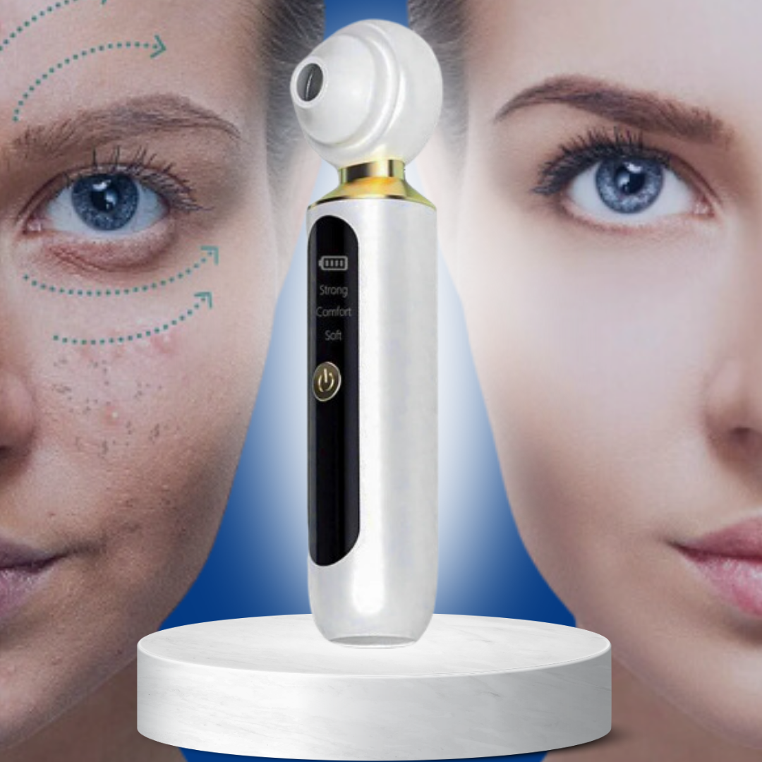 DermaPure™ - Blackhead remover