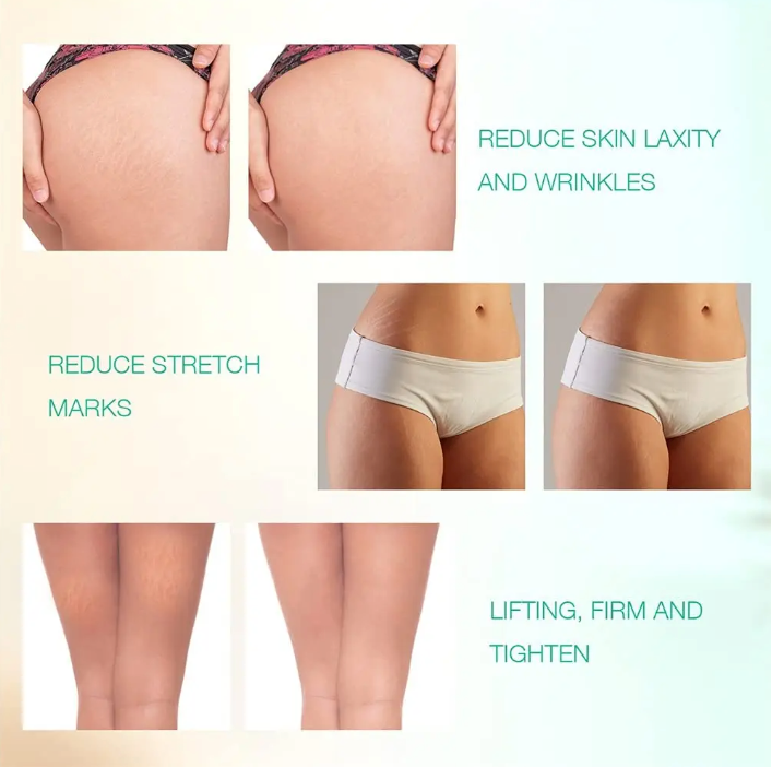 Radio Frequency Skin For Facial Body Eye Pro