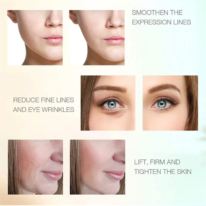 Radio Frequency Skin For Facial Body Eye Pro
