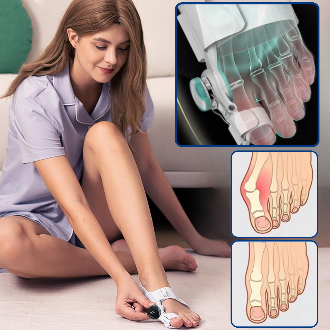 Flexicorrect™ - The #1 bunion corrector