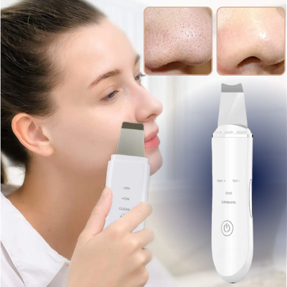 SonicPure Glow - The #1 Blackhead remover