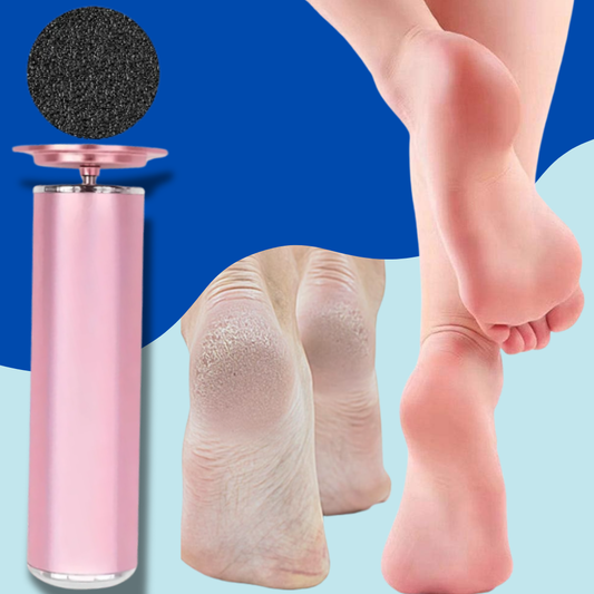 HeelRenew™ - Foot callus remover