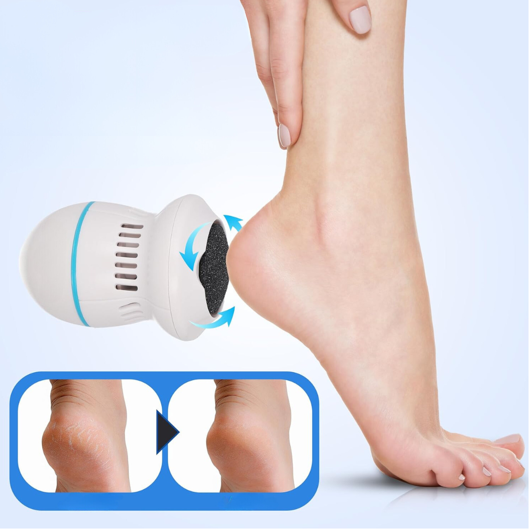 NanoGrip Foot Care - The #1 Foot Callus