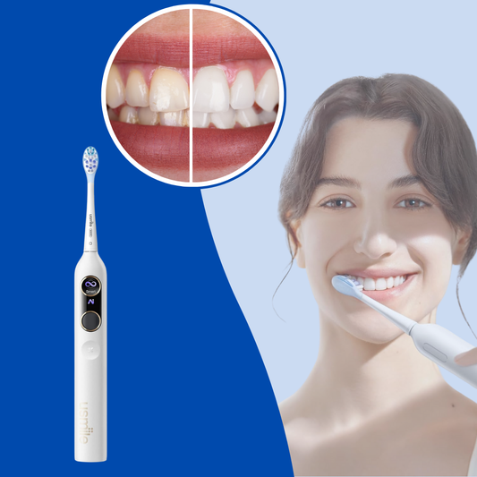 SpotlessSmile Pro™ - Electric Toothbrush