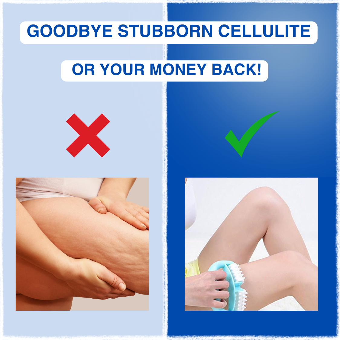 MyoGlow Roller™ -Cellulite Massager