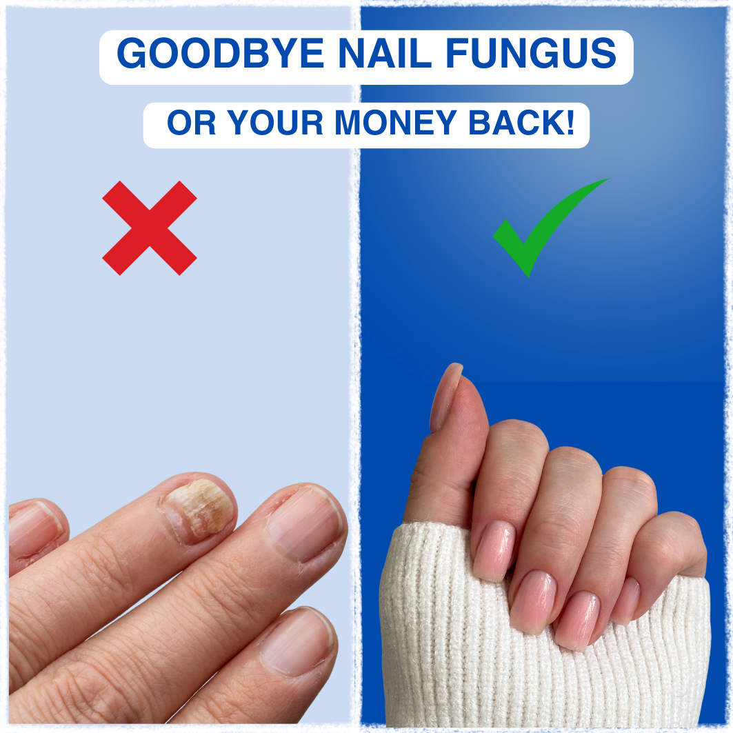 FungiFree Laser™ - Nail fungus treatment