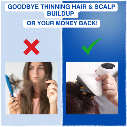 SmartScalp™ -Electric scalp massager
