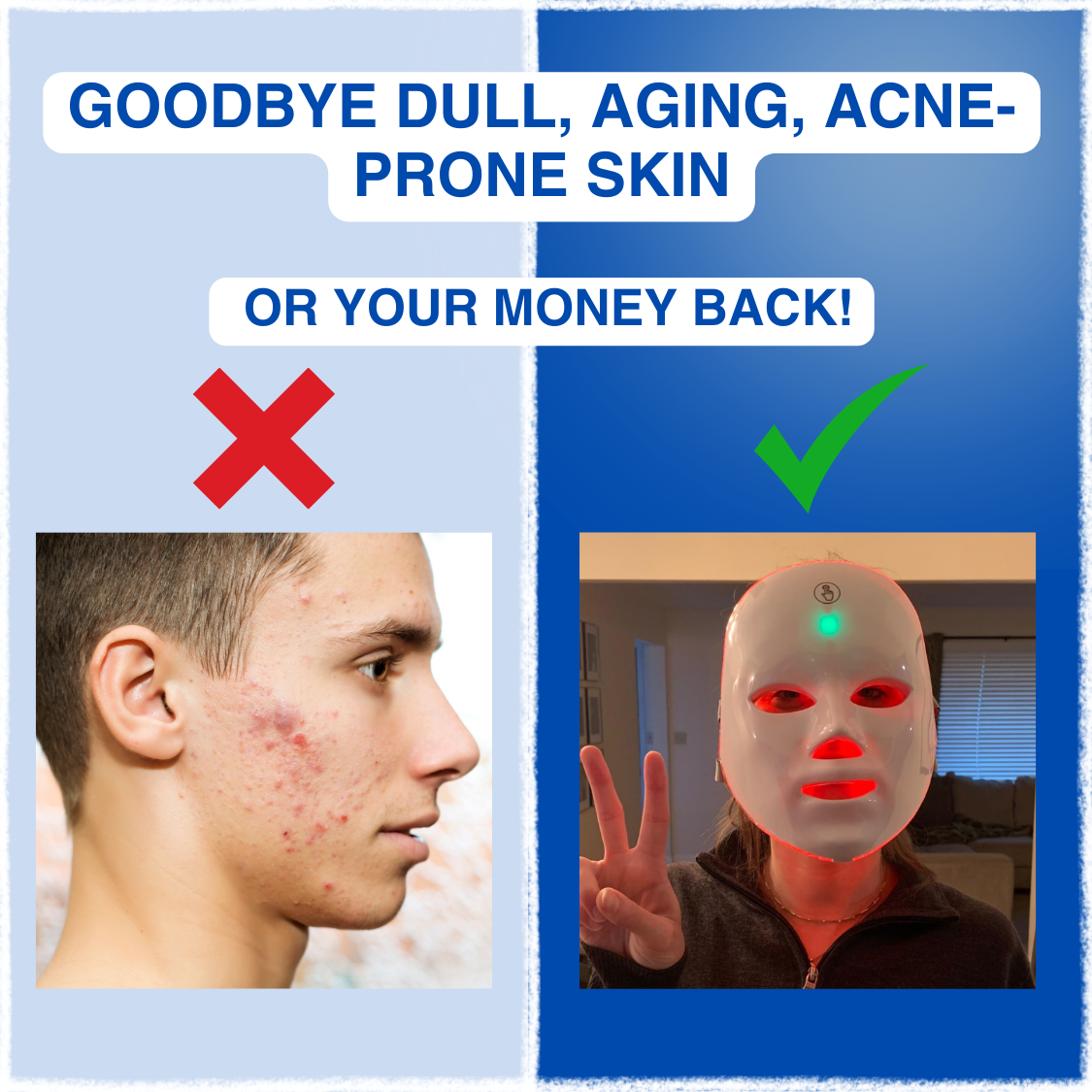 DermoNova 7™ - LED face mask