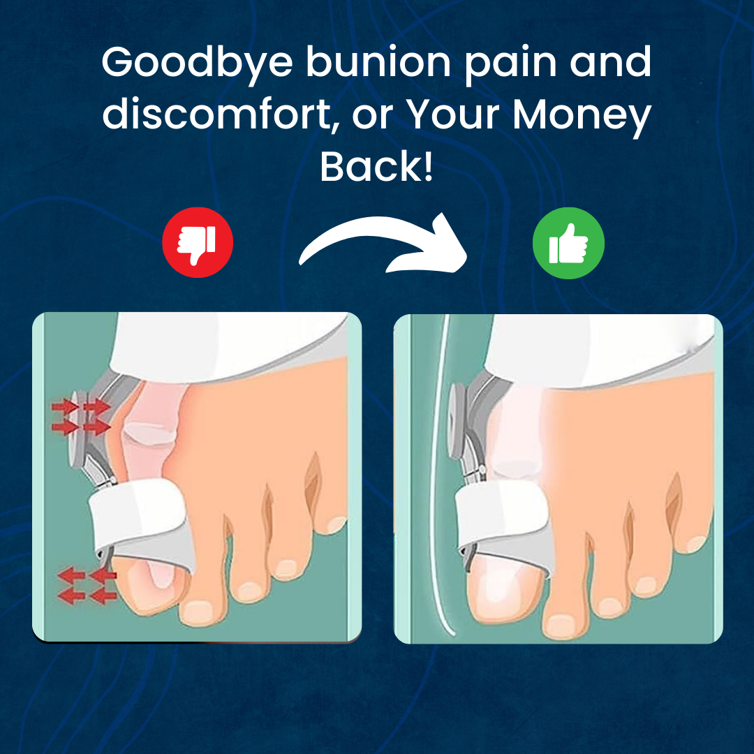 Flexicorrect™ - The #1 bunion corrector