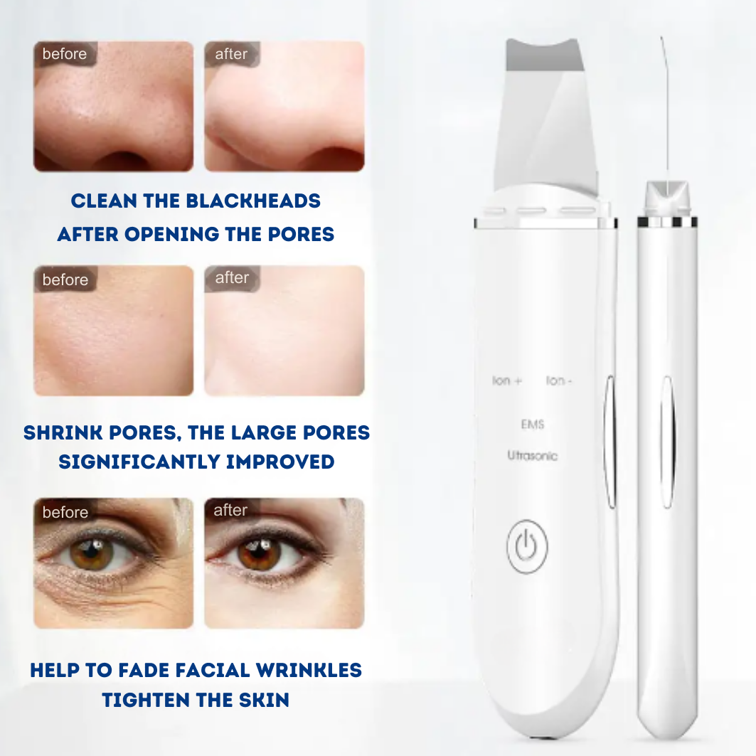 SonicPure Glow - The #1 Blackhead remover