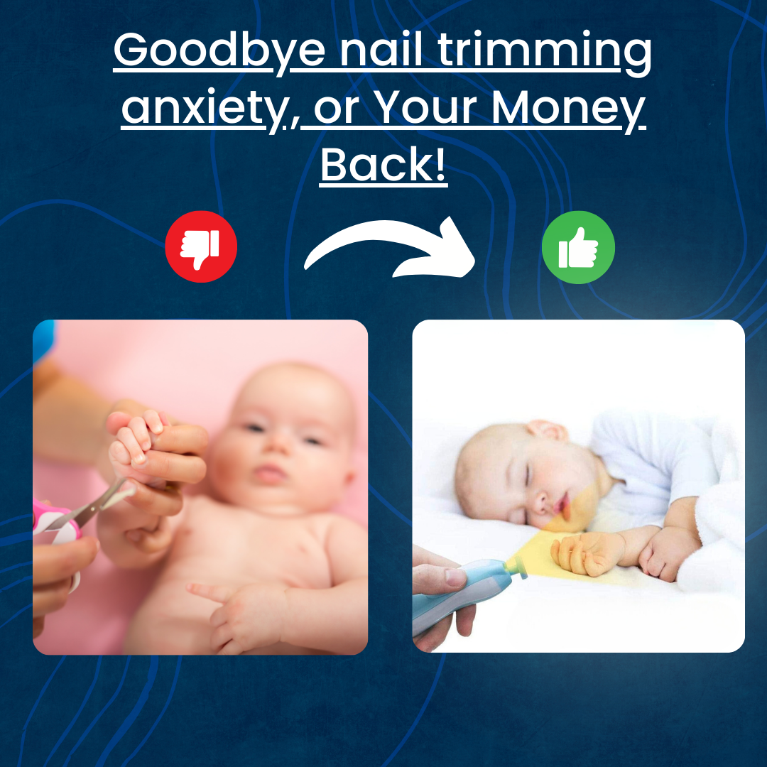 Trimmy™ - Electric Baby Nail Trimmer