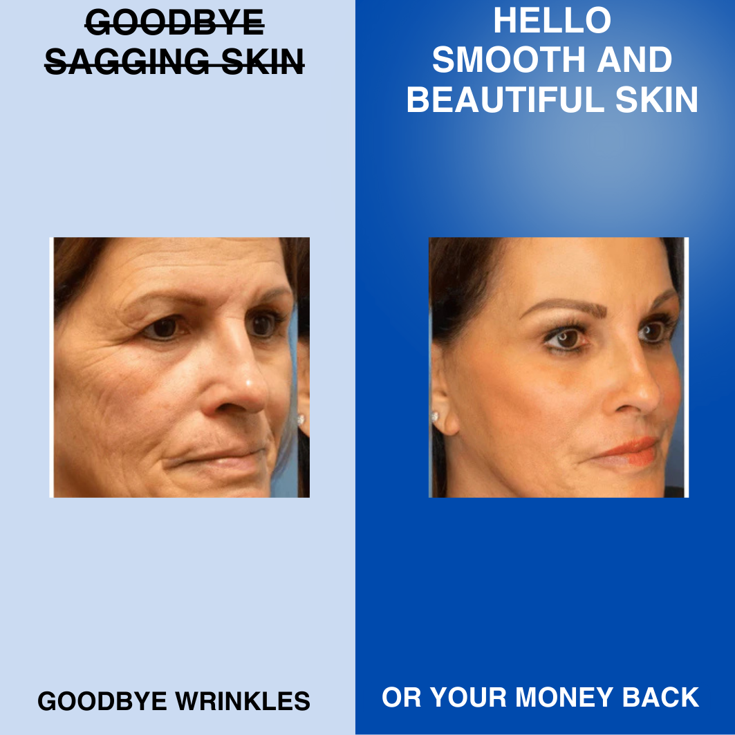 GlowLift Pro™ - Anti-Aging