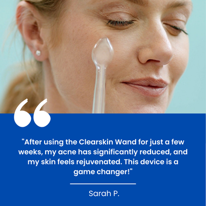 Clearskin Wand™ - The #1 high frequency wand