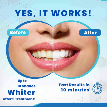 CrystalClear - The #1 Teeth whitening