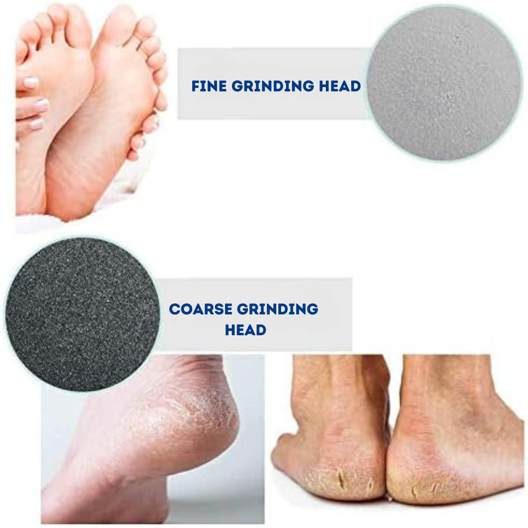 NanoGrip Foot Care - The #1 Foot Callus