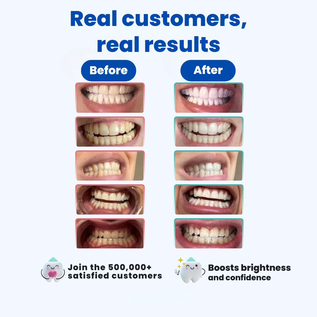 CrystalClear - The #1 Teeth whitening