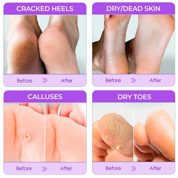 Peeling Foot Masks - The #1 Baby foot peel