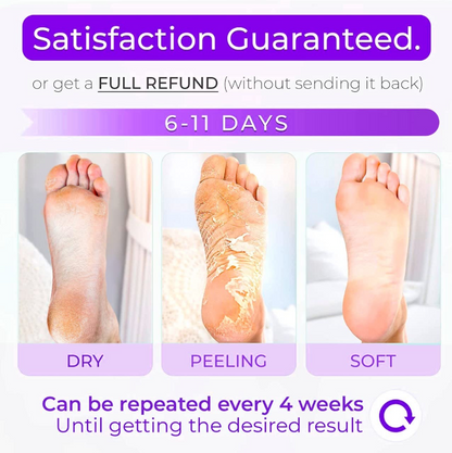 Peeling Foot Masks - The #1 Baby foot peel