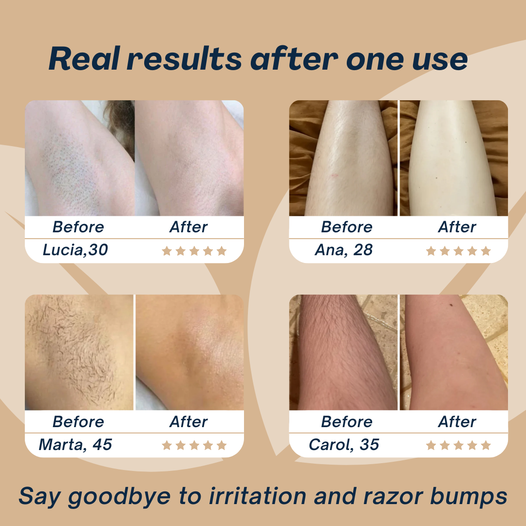 Barely™ - Bikini Trimir,  Body Shaver & Hair Remover for Smooth